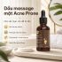 Dầu massage mặt Kobi Acne Prone 100ml cho da mụn, hỗ trợ massage chăm sóc da mặt nhẹ nhàng.