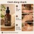 Hướng dẫn massage với dầu Kobi Stress & Anxiety ở cổ vai gáy, lưng hoặc tay chân để thư giãn.